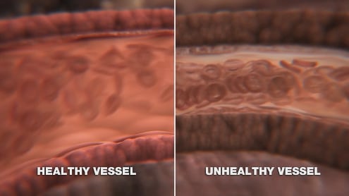 blood-vessels.png