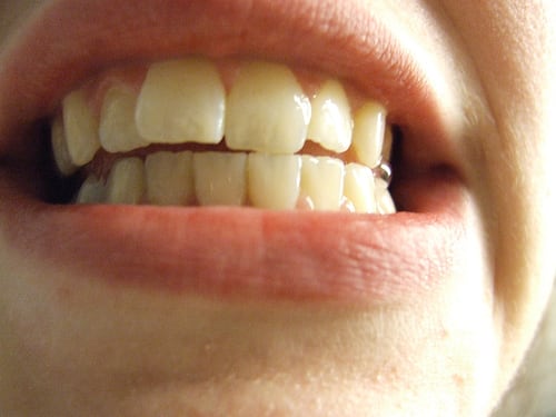 Teeth-Flickr-Mike-Burns.jpg