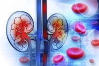 Optimized-kidney disease
