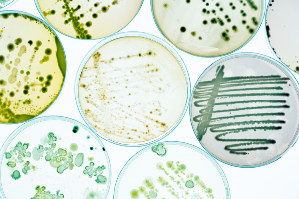GettyImages-luchschen microbial microbes petri dishes safety contamination